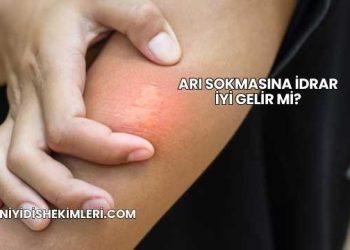 Arı Sokmasına İdrar İyi Gelir mi?