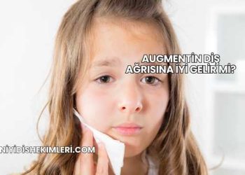 Augmentin Diş Ağrısına İyi Gelir mi?