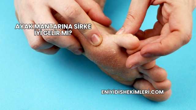Ayak Mantarına Sirke İyi Gelir mi?