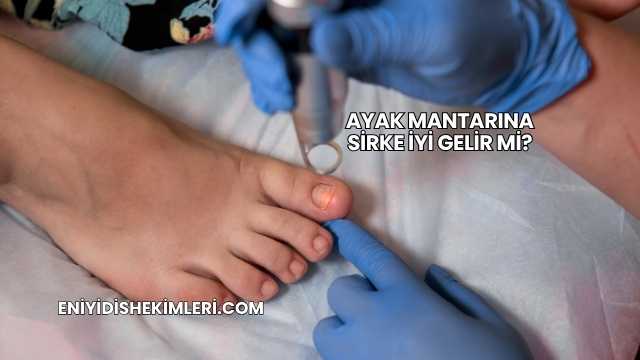 Ayak Mantarına Sirke İyi Gelir mi?