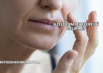 Azelderm Lekelere İyi Gelir mi?