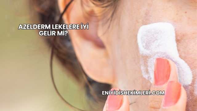 Azelderm Lekelere İyi Gelir mi?