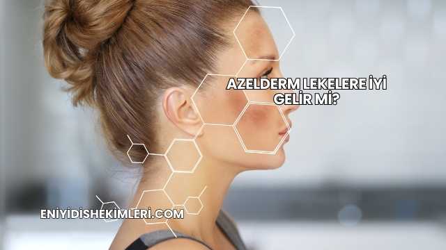 Azelderm Lekelere İyi Gelir mi?