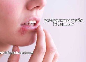 Balaban Krem Uçuğa İyi Gelir mi?