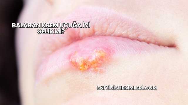 Balaban Krem Uçuğa İyi Gelir mi?