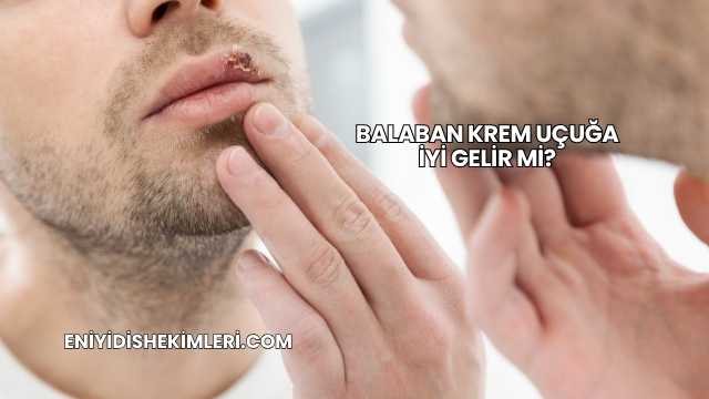 Balaban Krem Uçuğa İyi Gelir mi?