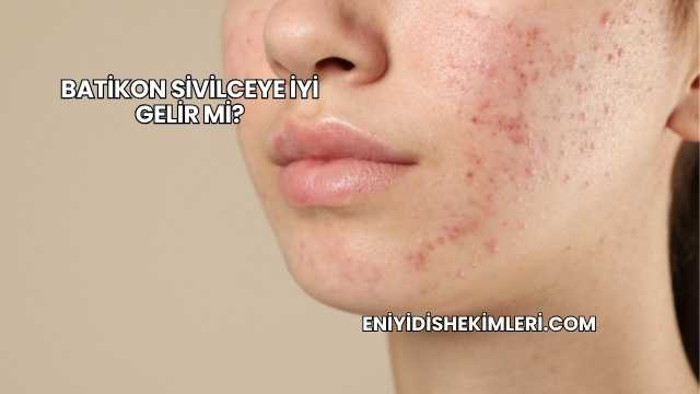 Batikon Sivilceye İyi Gelir mi?