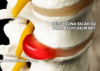 Bel Fıtığına Sıcak Su Torbası İyi Gelir mi?