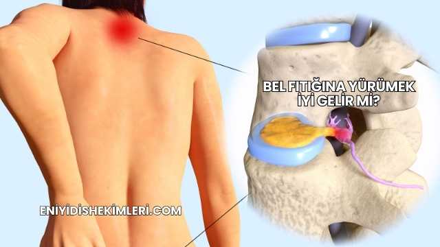 Bel Fıtığına Yürümek İyi Gelir mi?