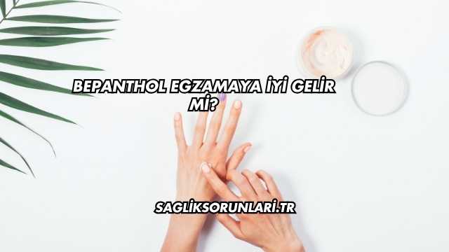 Bepanthol Egzamaya İyi Gelir mi?