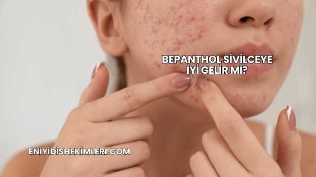 Bepanthol Sivilceye İyi Gelir mi?