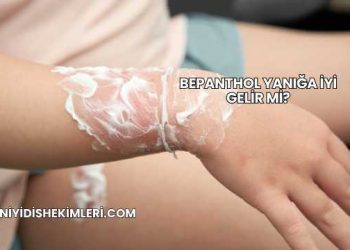 Bepanthol Yanığa İyi Gelir mi?