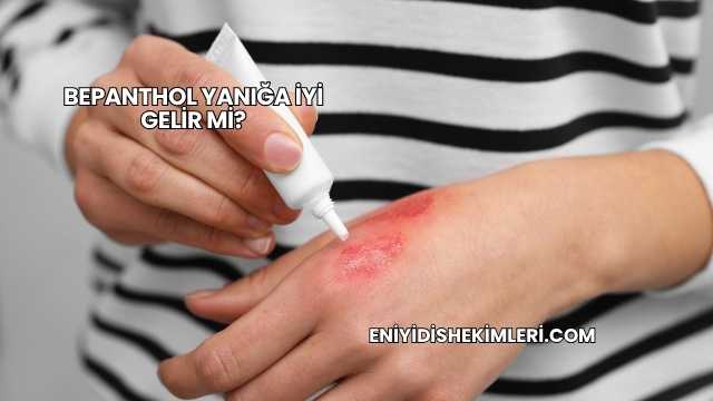 Bepanthol Yanığa İyi Gelir mi?