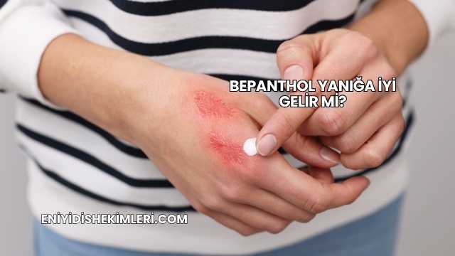 Bepanthol Yanığa İyi Gelir mi?