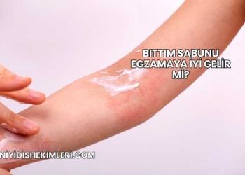 Bıttım Sabunu Egzamaya İyi Gelir mi?