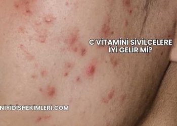 C Vitamini Sivilcelere İyi Gelir mi?