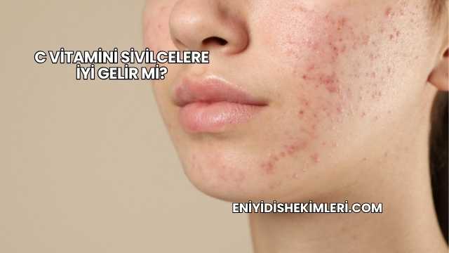 C Vitamini Sivilcelere İyi Gelir mi?