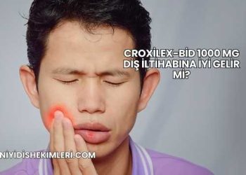 Croxilex-Bid 1000 Mg Diş İltihabına İyi Gelir mi?