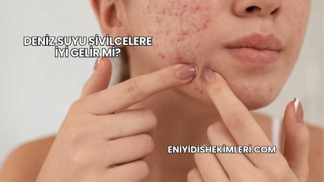Deniz Suyu Sivilcelere İyi Gelir mi?