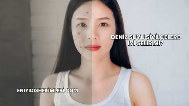 Deniz Suyu Sivilcelere İyi Gelir mi?