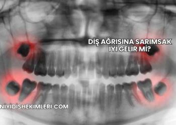 Diş Ağrısına Sarımsak İyi Gelir mi?