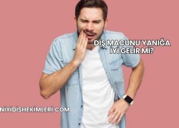Diş Macunu Yanığa İyi Gelir mi?