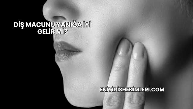 Diş Macunu Yanığa İyi Gelir mi?
