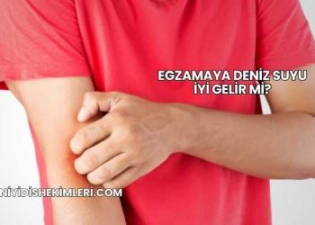 Egzamaya Deniz Suyu İyi Gelir mi?