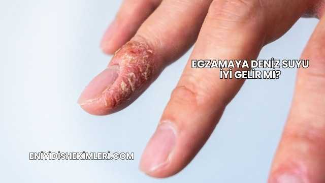 Egzamaya Deniz Suyu İyi Gelir mi?