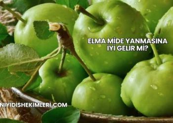 Elma Mide Yanmasına İyi Gelir mi?