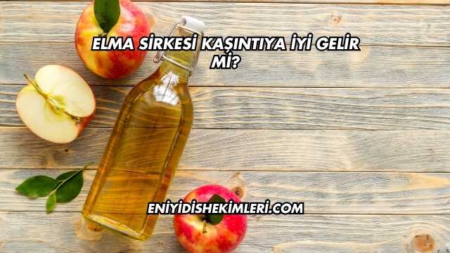 Elma Sirkesi Kaşıntıya İyi Gelir mi?