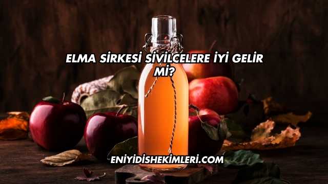 Elma Sirkesi Sivilcelere İyi Gelir mi?