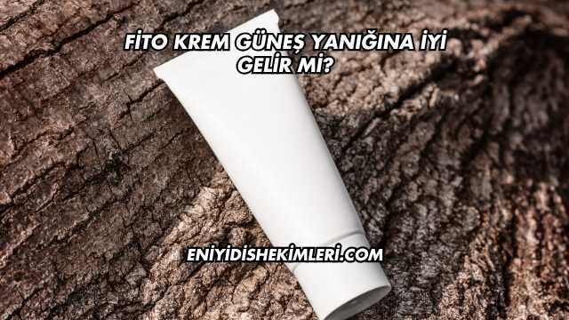 Fito Krem Güneş Yanığına İyi Gelir mi?