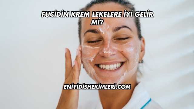 Fucidin Krem Lekelere İyi Gelir mi?