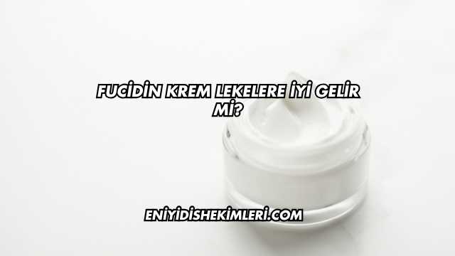 Fucidin Krem Lekelere İyi Gelir mi?
