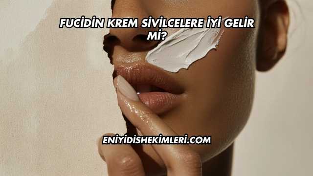 Fucidin Krem Sivilcelere İyi Gelir mi?
