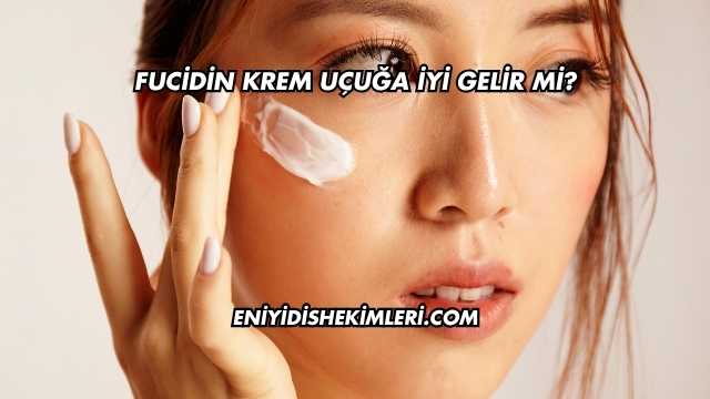 Fucidin Krem Uçuğa İyi Gelir mi?