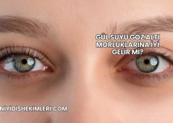 Gül Suyu Göz Altı Morluklarına İyi Gelir mi?
