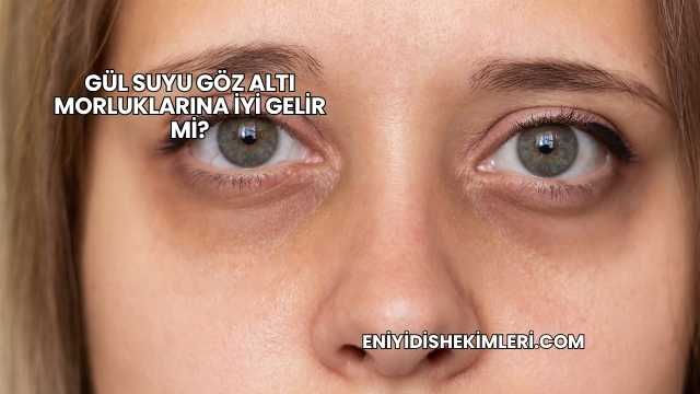 Gül Suyu Göz Altı Morluklarına İyi Gelir mi?