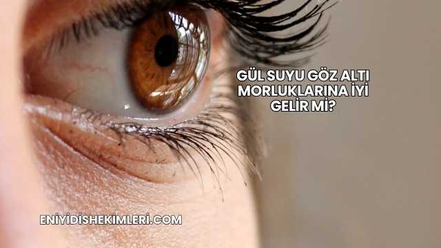 Gül Suyu Göz Altı Morluklarına İyi Gelir mi?