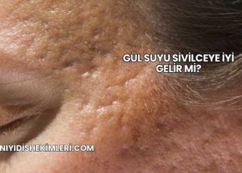 Gül Suyu Sivilceye İyi Gelir mi?