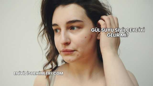 Gül Suyu Sivilceye İyi Gelir mi?