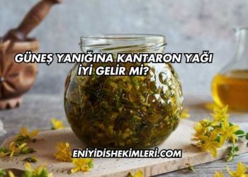 Güneş Yanığına Kantaron Yağı İyi Gelir mi?