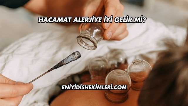 Hacamat Alerjiye İyi Gelir mi?