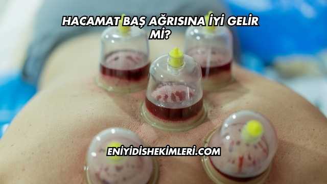 Hacamat Baş Ağrısına İyi Gelir mi?