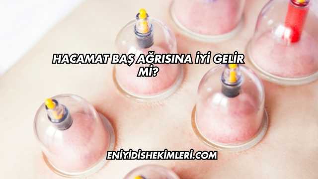 Hacamat Baş Ağrısına İyi Gelir mi?