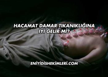 Hacamat Damar Tıkanıklığına İyi Gelir mi?