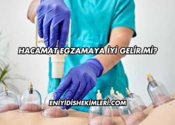 Hacamat Egzamaya İyi Gelir mi?
