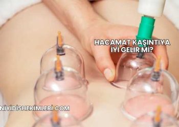 Hacamat Kaşıntıya İyi Gelir mi?