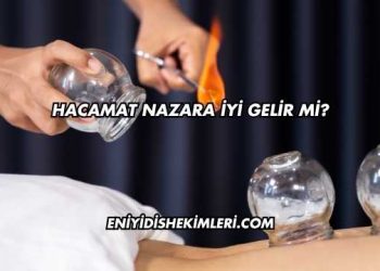 Hacamat Nazara İyi Gelir mi?